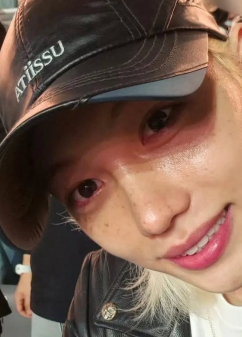 ATIISSU Wing Cap (Felix Wear)