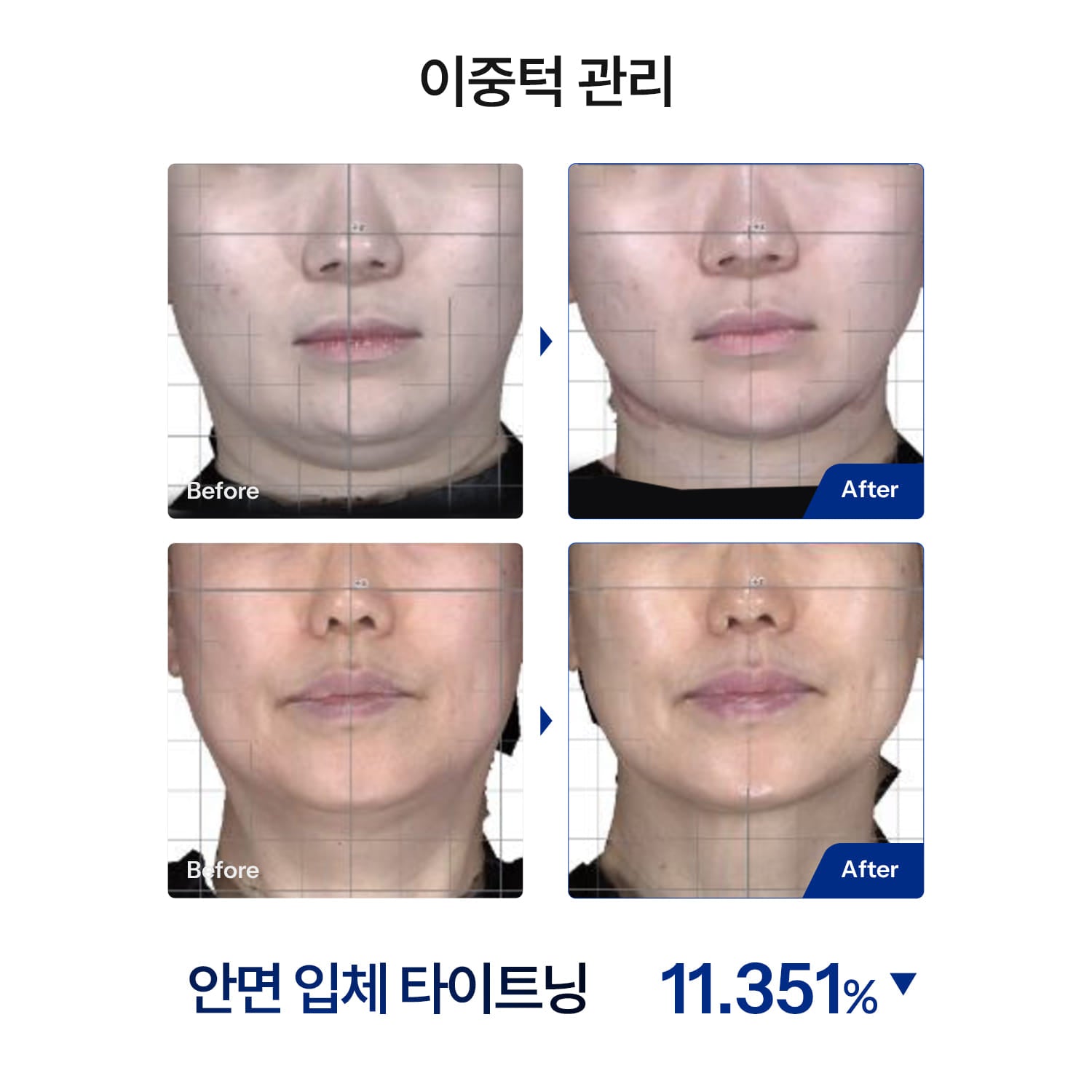 HOMEMODE THERMA LIFT Beauty Device (+3 Skin Booster Ampoules) HOMEMODE  DKshop