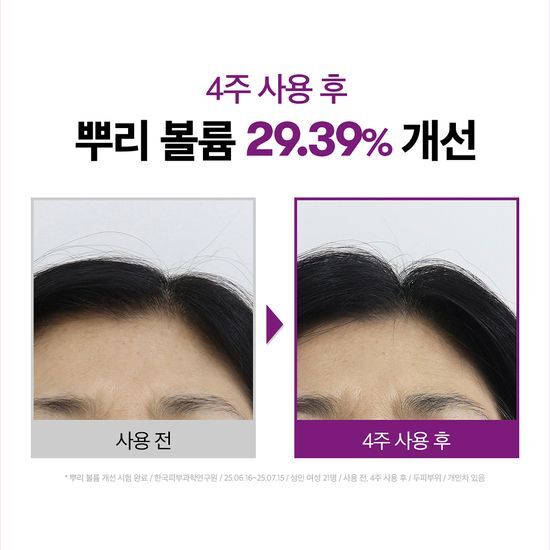 VT REEDLE SHOT HAIR BOOSTING AMPOULE 100dl (1+1) VT  DKshop