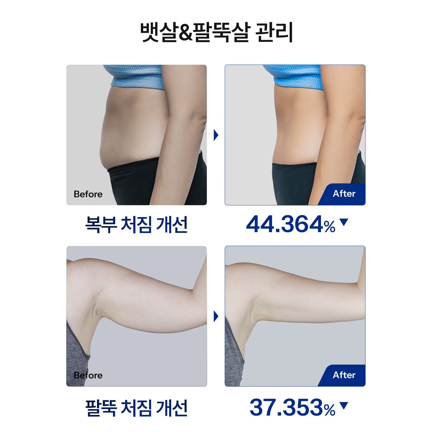 HOMEMODE THERMA LIFT Beauty Device (+3 Skin Booster Ampoules) HOMEMODE  DKshop