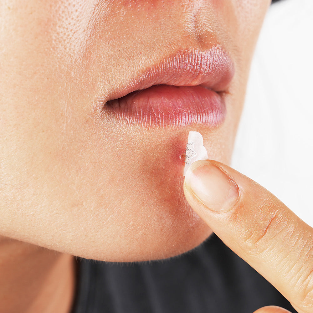 LALARECIPE TROUBLE SPOT PATCH LALARECIPE  DKshop